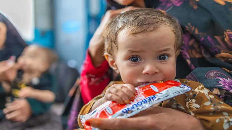UNICEF calls for urgent action as 3.7m Afghan children at risk of malnutrition