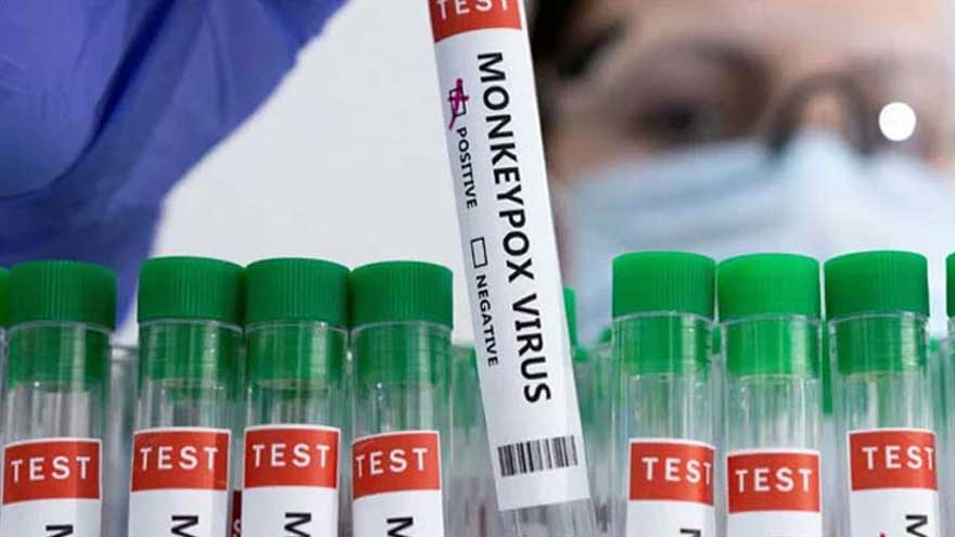Bahawalpur reports rise in suspected monkeypox cases