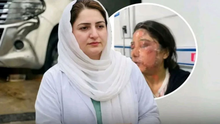 کوئٹہ میں تیزاب گردی کا نشانہ بننے والی ڈاکٹر ماہ نور کے چہرے کی پلی گرافٹنگ کردی گئی
