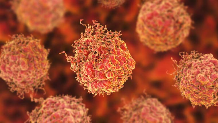 پروسٹیٹ کینسر کے لیے تیار کی گئی نئی دوا کی ابتدائی آزمائش مکمل