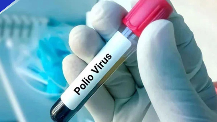 سندھ کے ضلع سجاول میں 2026 کا پہلا پولیو کیس رپورٹ