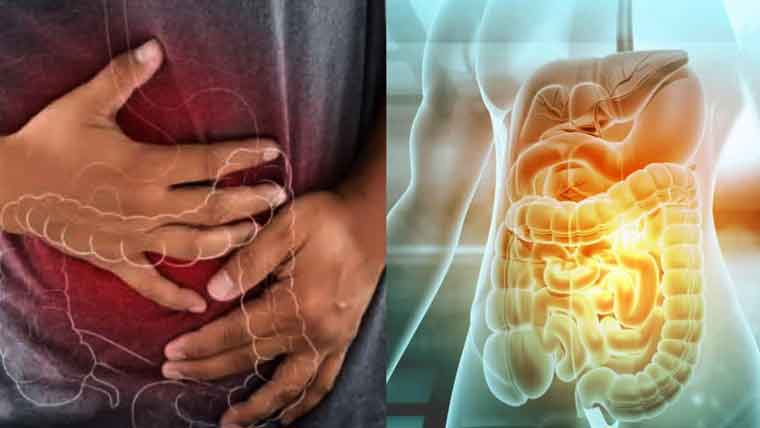 آنتوں کے زہریلے بیکٹیریا بڑی آنت کے کینسر کا موجب ہیں:  طبی ماہرین کا دعویٰ