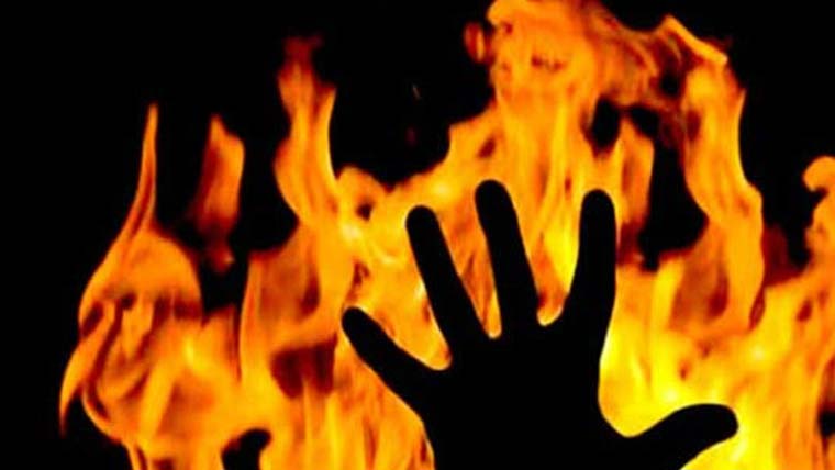 کراچی: گھر میں آتشزدگی سے جھلسنے والی خاتون دوران علاج دم توڑ گئی