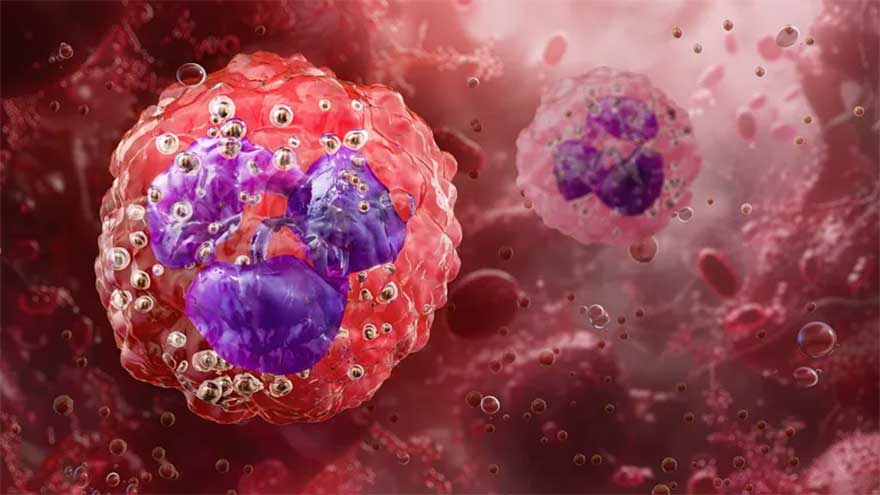 Common asthma drug helps fight hard-to-treat cancers, study finds