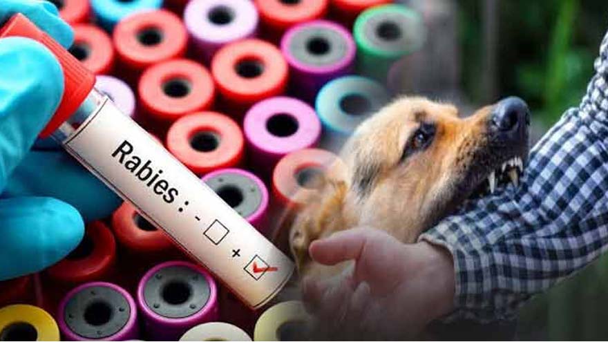 Hyderabad man dies of rabies at Karachi's Jinnah Hospital