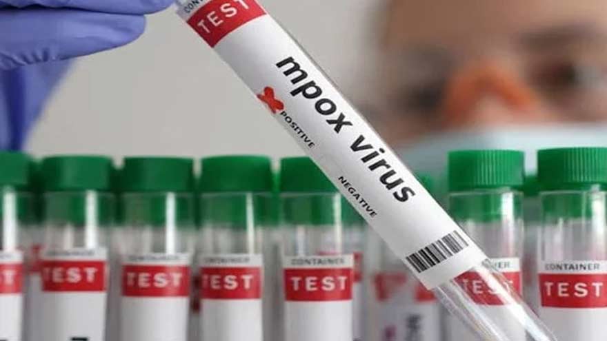 KP reports four new mpox cases, total infections reach 18