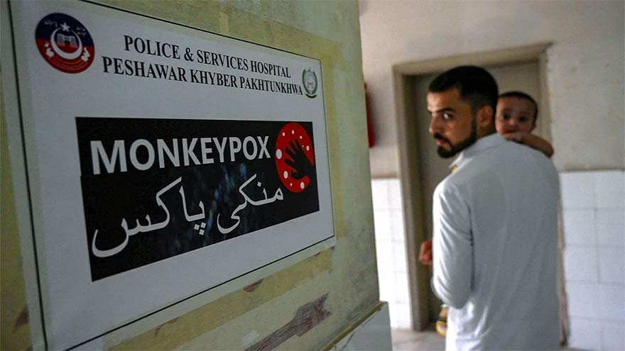 Karachi reports two mpox cases this week, taking 2026 tally to 15